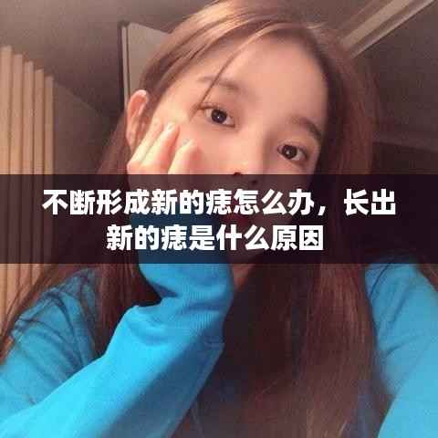不断形成新的痣怎么办,长出新的痣是什么原因
