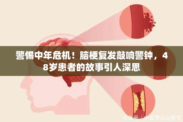 警惕中年危机！脑梗复发敲响警钟，48岁患者的故事引人深思